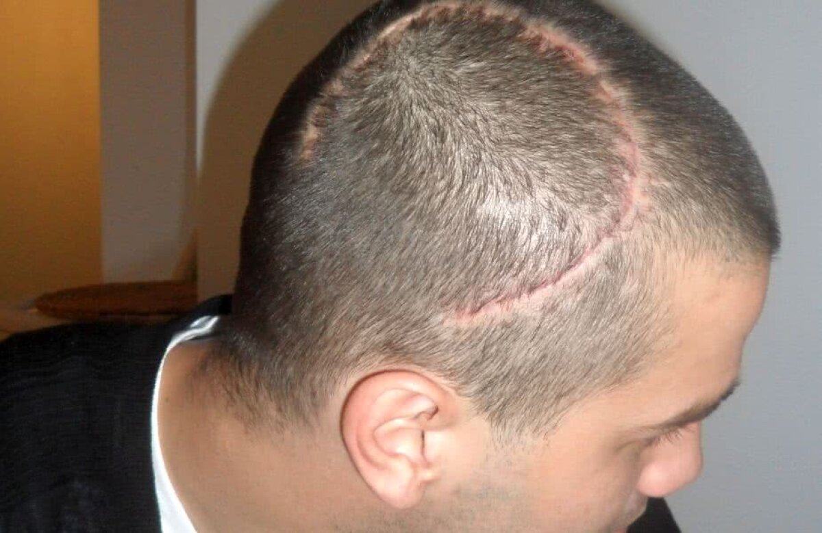 EXCLUSIV Mărturisiri cutremurătoare făcute de Chivu: "Nu mai simt nimic cu degetele mâinii stângi. NIMIC!"