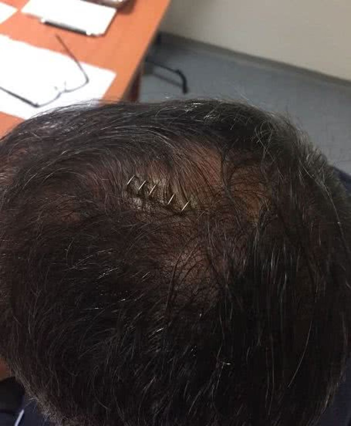 VIDEO + FOTO Evenimente incredibile la Fenerbahce - Beșiktaș! Antrenorul oaspeților a ajuns la spital și s-a ales cu 5 cusături în creștetul capului » Meciul a fost oprit