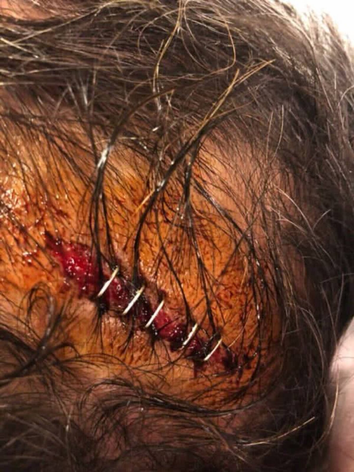 VIDEO + FOTO Bătaie groaznică între oficialii lui Fener și Beșiktaș » Imagini nemaivăzute pe un teren de fotbal