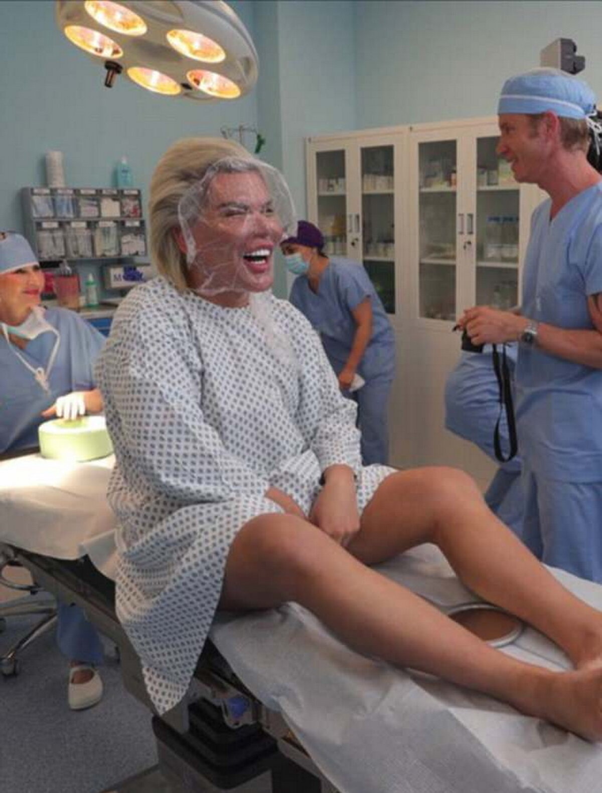 GALERIE FOTO Ultima nebunie a păpuşii umane Ken: Şi-a injectat celule stem în faţă!