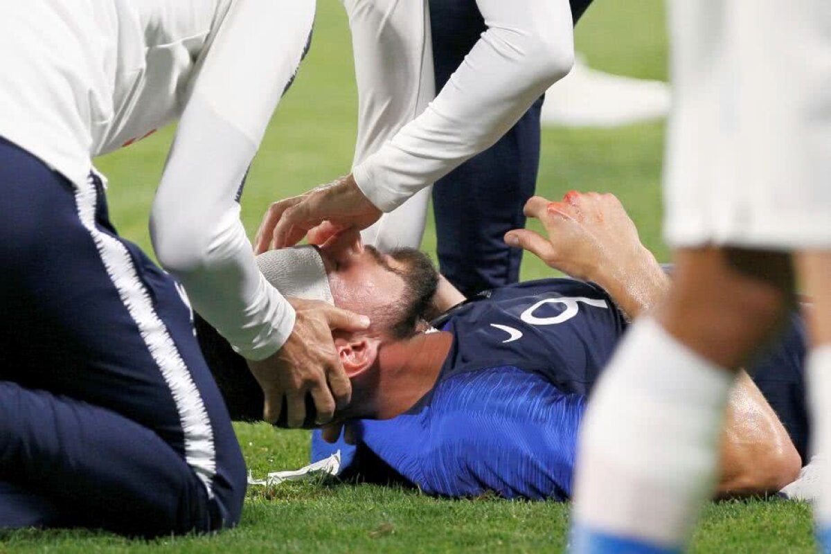 FOTO Giroud a vărsat sânge! S-a ales cu 6 copci după o ciocnire violentă cu Mezga