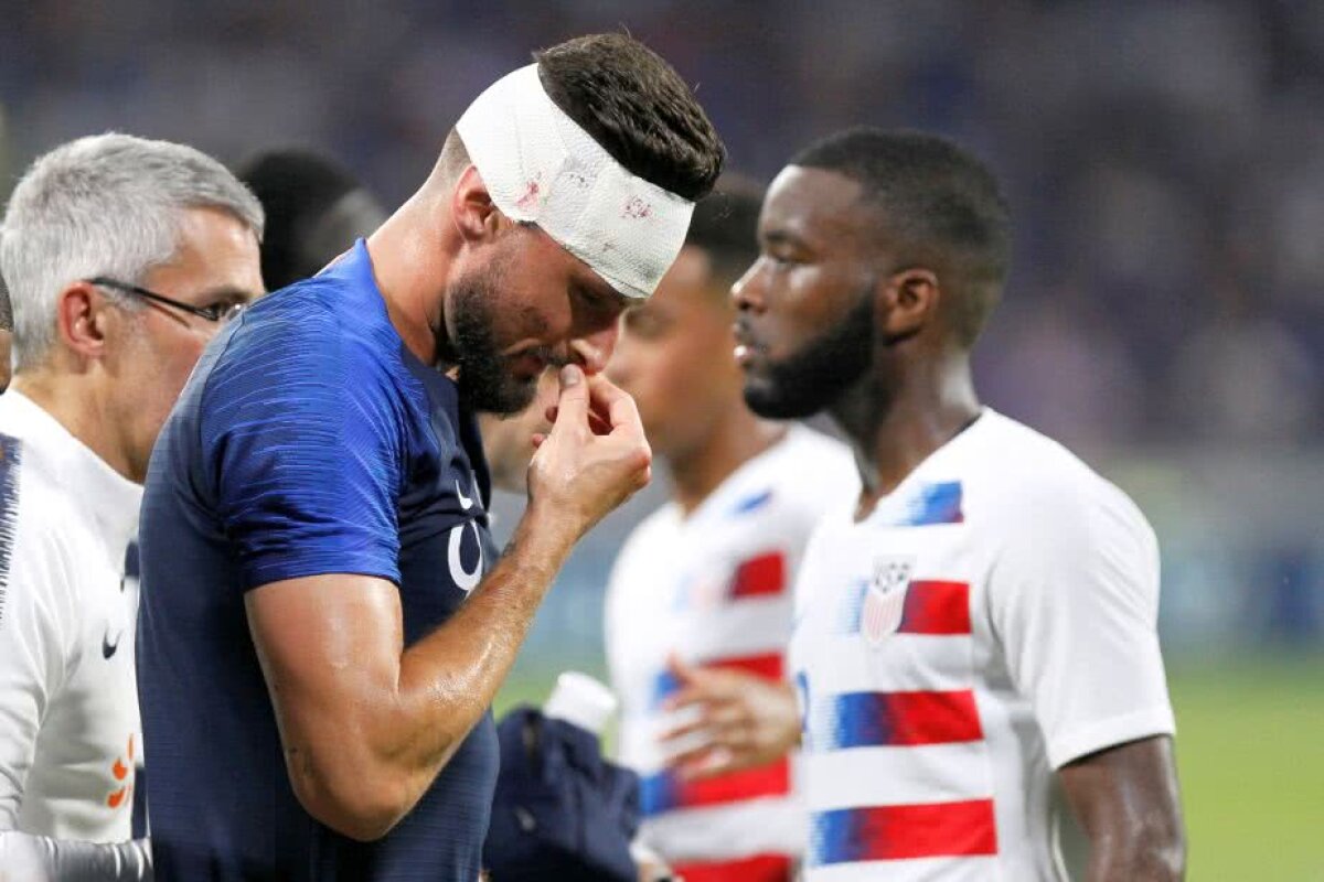 FOTO Giroud a vărsat sânge! S-a ales cu 6 copci după o ciocnire violentă cu Mezga