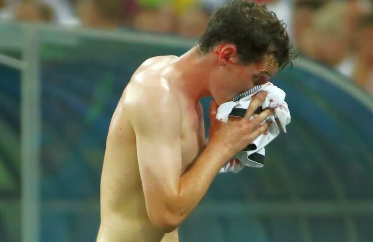 GALERIE FOTO Accidentare șocantă în Germania - Suedia » Accidentare involuntară, hemoragie incontrolabilă și nervi pe margine