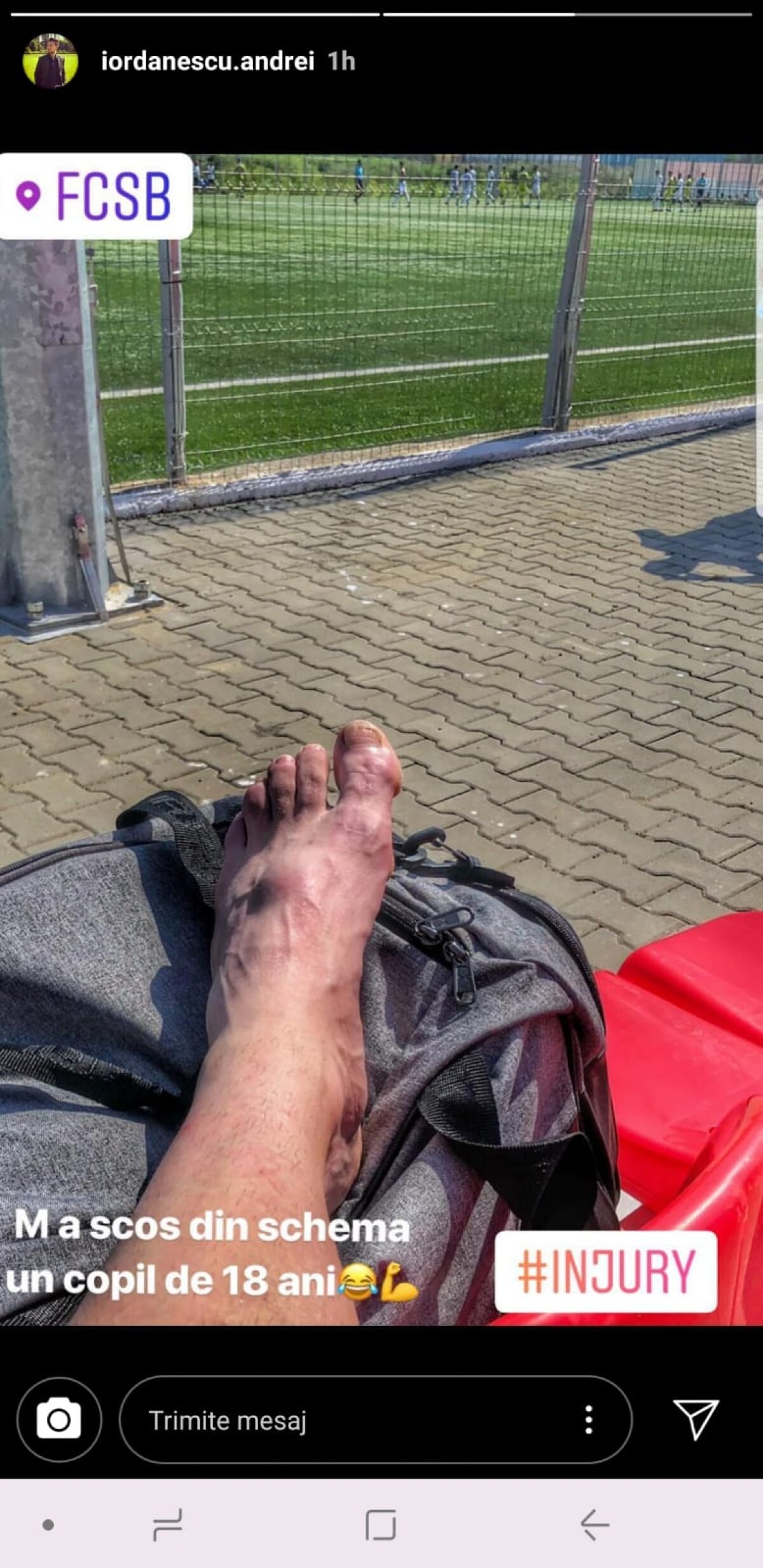 FOTO Imagine șocantă » Accidentare teribilă suferită de Andrei Iordănescu în meciul cu FCSB