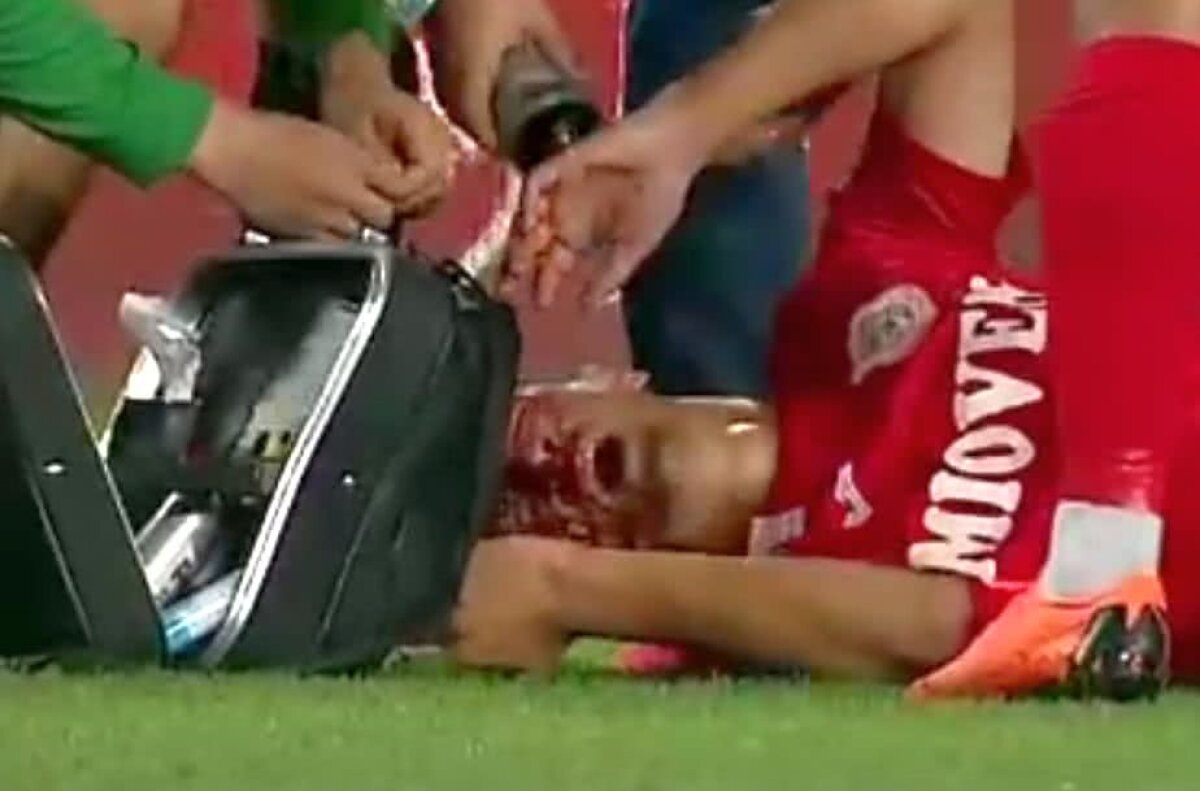 FOTO Atenție, imagini de groază de la Ploiești! Un fotbalist s-a prăbușit pe teren plin de sânge 