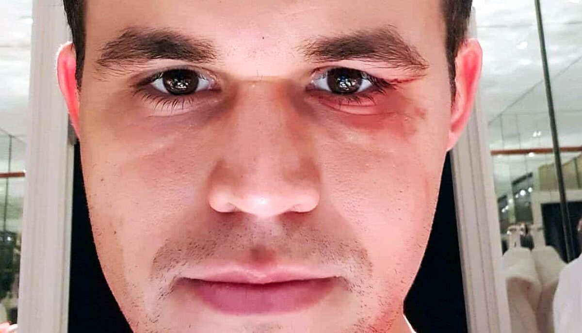 Fotografia zilei - cele mai interesante imagini ale lunii noiembrie 2018 în sport