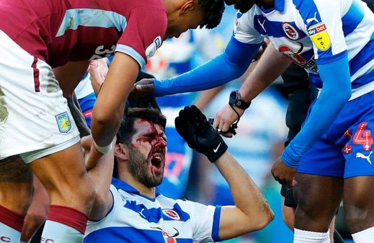 NELSON OLIVEIRA // FOTO ȘOCANT! Accidentare horror la un meci din Anglia: umplut de sânge după ce a fost călcat pe față