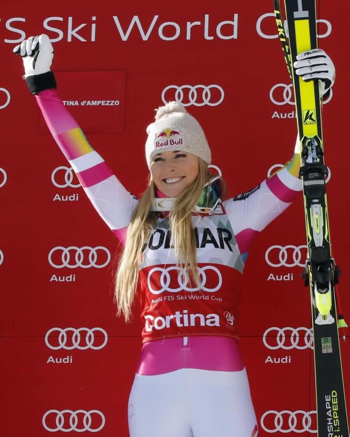 FOTO Și-au arătat vânătăile! Imagine inedită postată de Lindsey Vonn după ce a căzut de pe schiuri