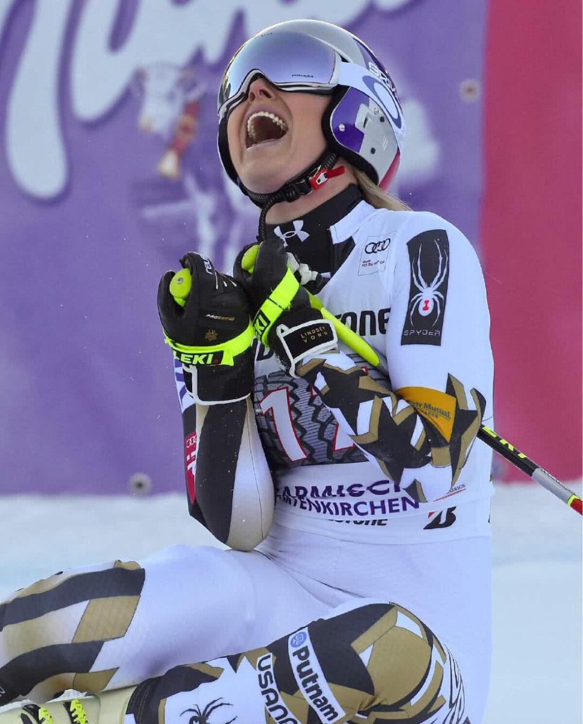 FOTO Și-au arătat vânătăile! Imagine inedită postată de Lindsey Vonn după ce a căzut de pe schiuri