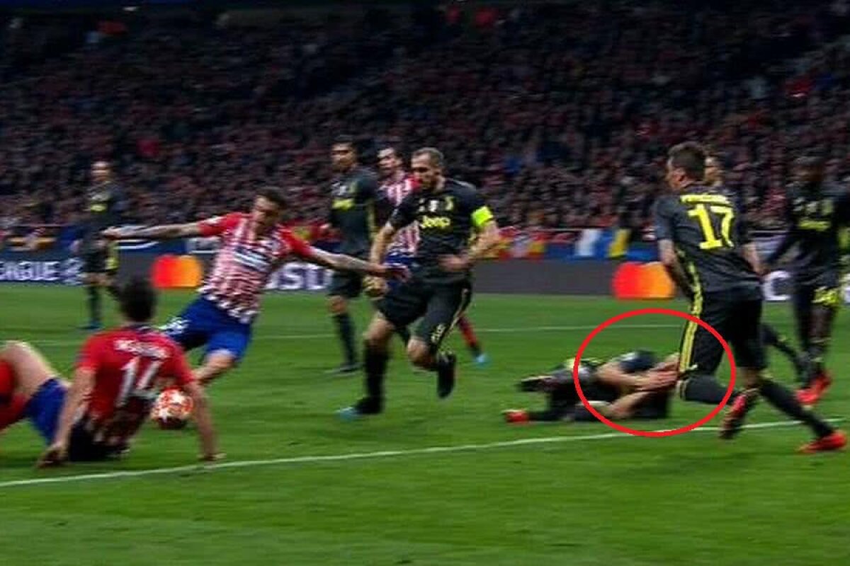 ATLETICO MADRID - JUVENTUS 2-0 // GALERIE FOTO + VIDEO Fază incredibilă! Bonucci a simulat o lovitură în figură, apoi și-a luat mâna de pe față ca să vadă faza!  