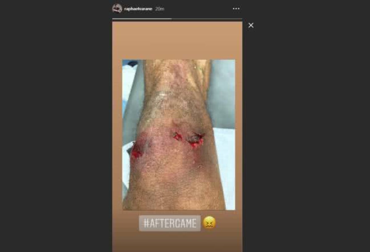 REAL MADRID - BARCELONA 0-3 // FOTO Genunchi franjuri! Imagine groaznică: autogol și autoaccidentare pentru Varane