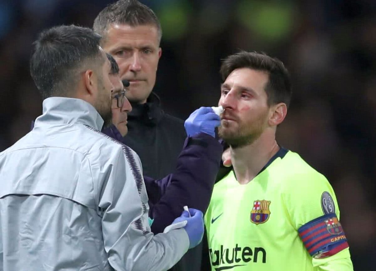 Man. United - Barcelona 0-1 // FOTO Messi e suspect de fisură de sept nazal Reacția agresorului Smalling: „Știam că trebuie să jucăm cu intensitate”
