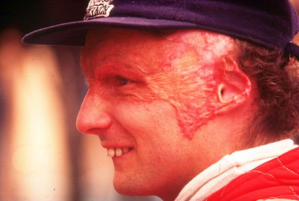 FORMULA 1. Niki Lauda, campion mondial cu Ferrari și McLaren, a murit la 70 de ani