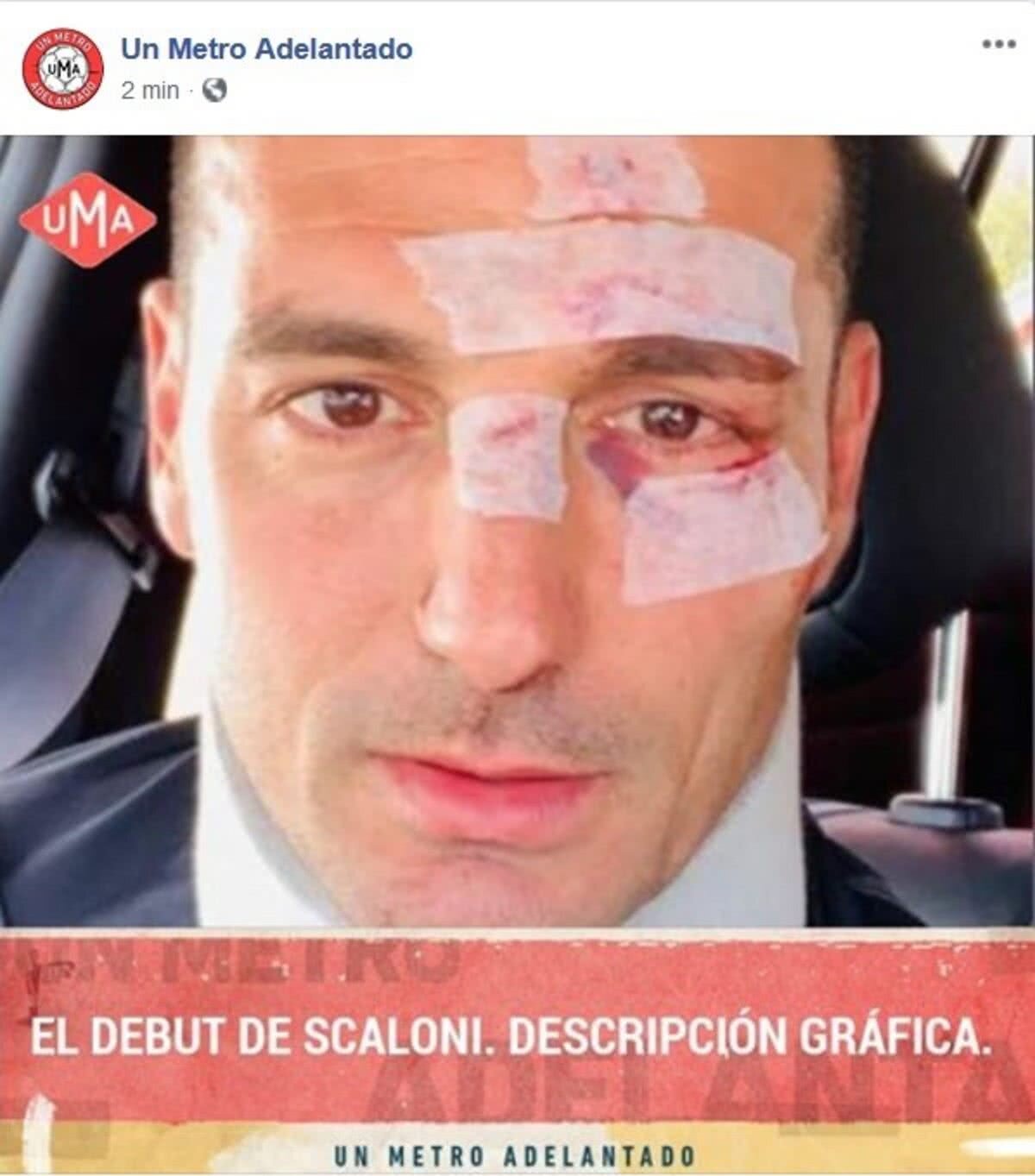 Argentina - Columbia 0-2 // VIDEO+FOTO Șoc la Copa América! Leo Messi s-a dat cu capul de zidul columbian: „Imposibil mai rău de atât. Aceeași poveste dintotdeauna”