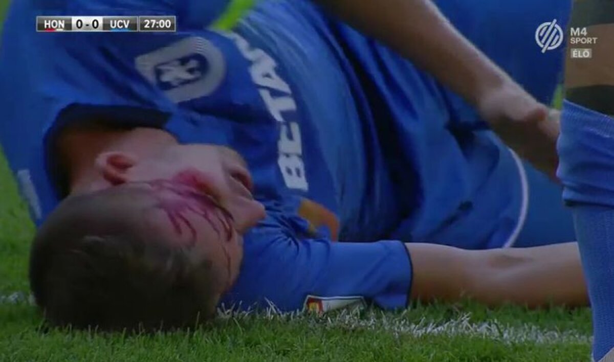 HONVED - CRAIOVA 0-0 // FOTO Imagini dure în Ungaria: Nicușor Bancu, plin de sânge, a fost cusut chiar pe teren