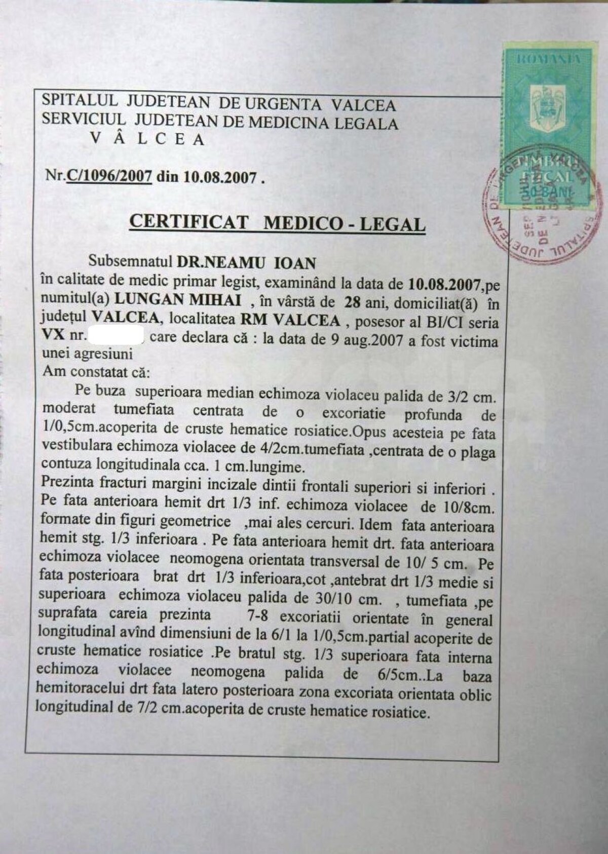 EXCLUSIV VIDEO Bătaie în vestiarul unei foste echipe de Liga 1: „A fost o altercație la baie” / „Mi-au spart dinții și mi-au rupt coastele”