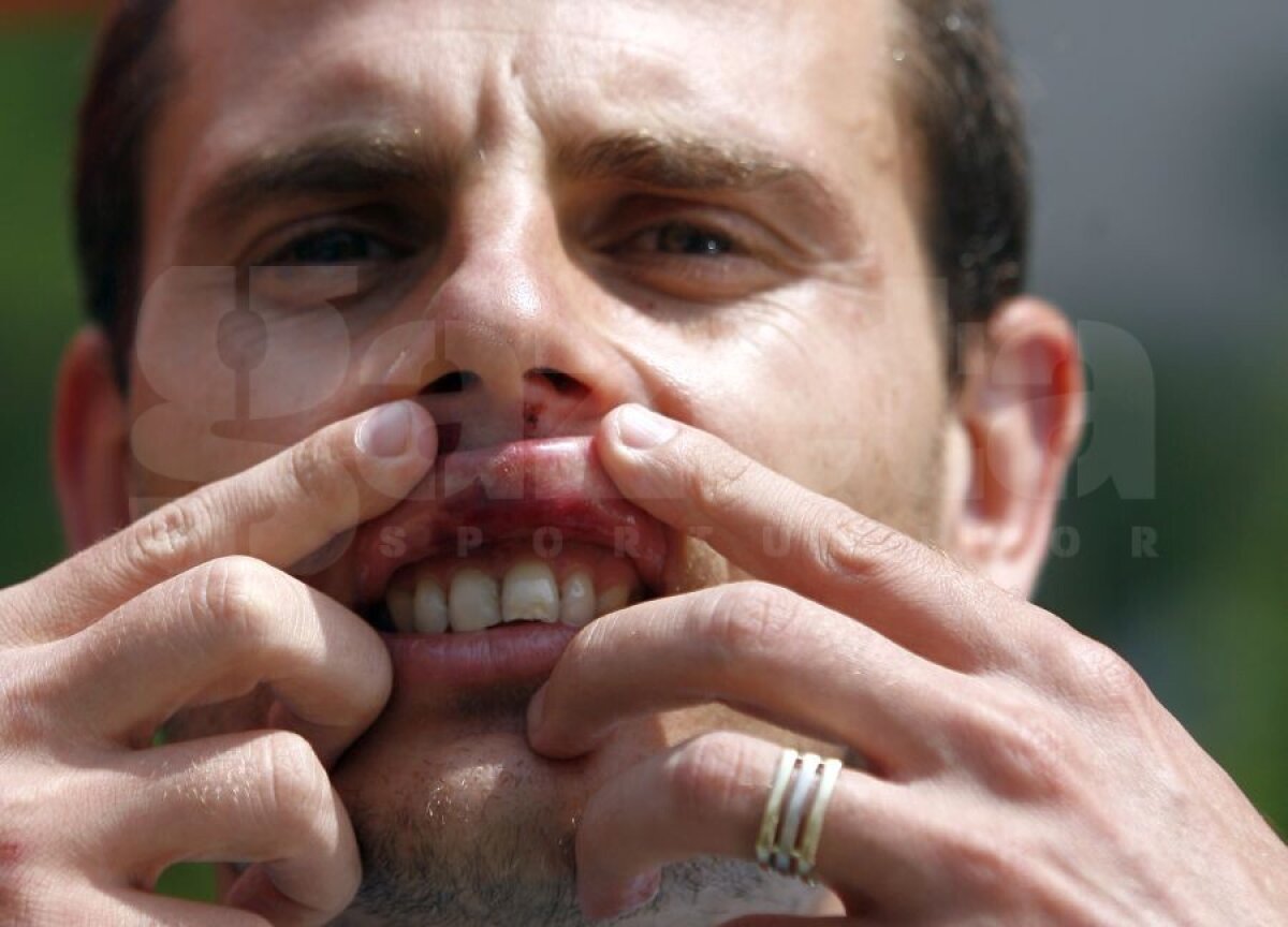 EXCLUSIV VIDEO Bătaie în vestiarul unei foste echipe de Liga 1: „A fost o altercație la baie” / „Mi-au spart dinții și mi-au rupt coastele”