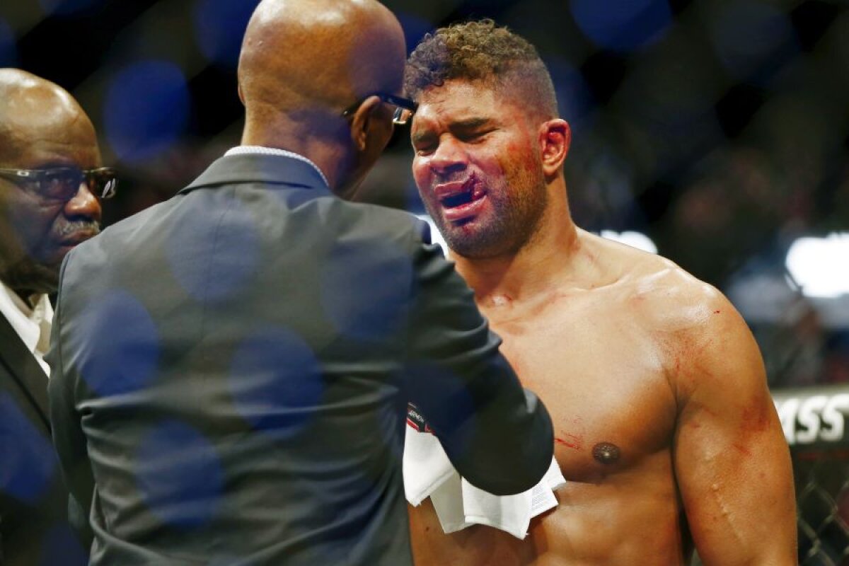 VIDEO + FOTO Alistair Overeem, accidentare HORROR! Nu s-a mai văzut așa ceva în istoria UFC! Atenție, imagini care vă pot afecta emoțional