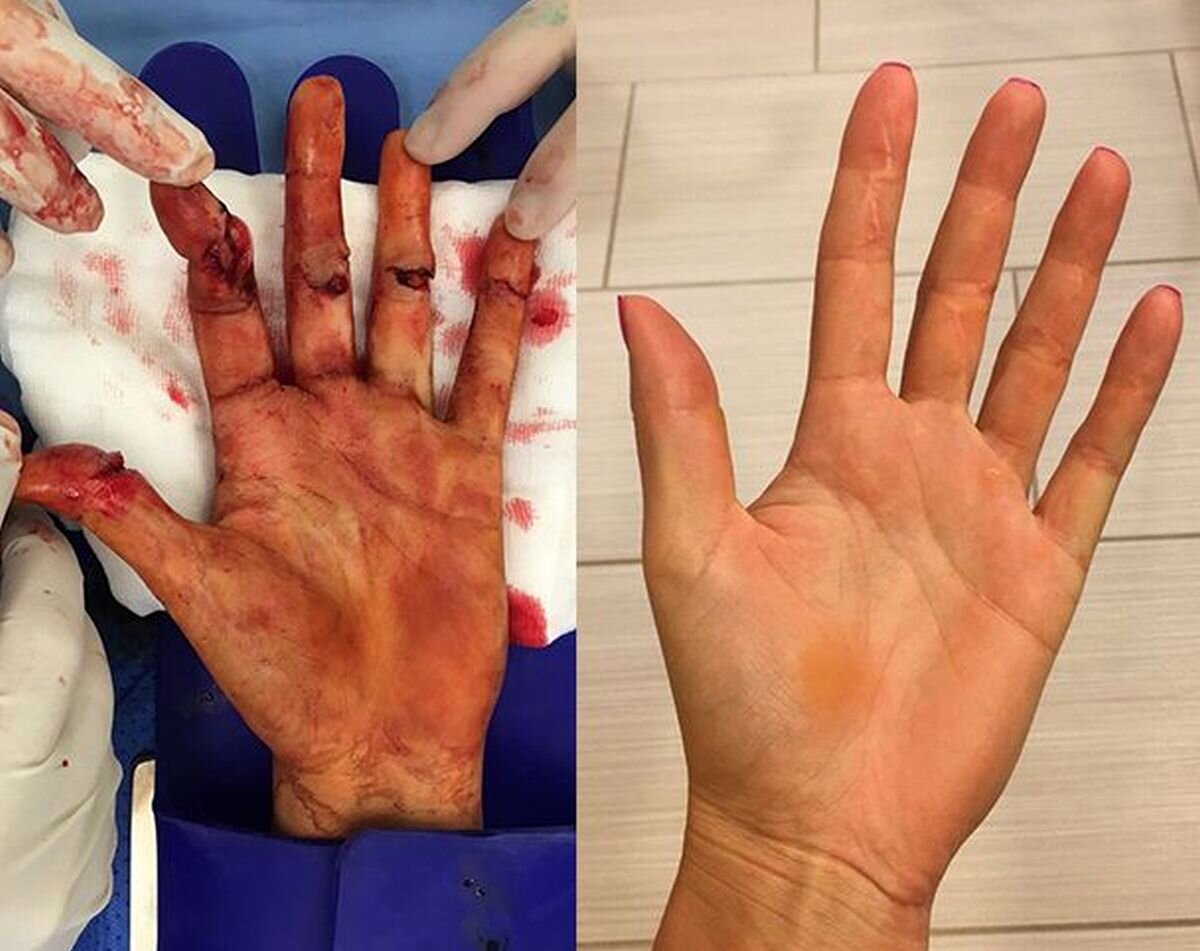 Povestea de groază prin care a trecut Petra Kvitova, campioana de Grand Slam care o înfruntă pe Sorana Cîrstea în semifinale la WTA Miami: „I-a pus cuțitul la gât”