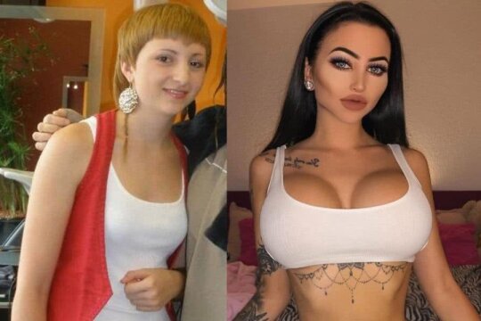 Celine Centino, înainte și după operație