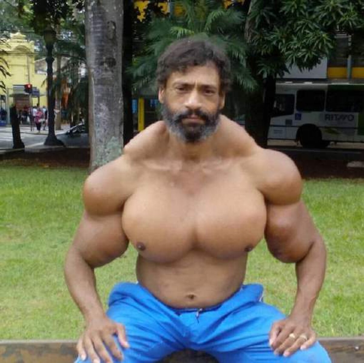 Synthol Leaking