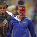 Imaginea fanului însîngerat a
fost preluată de site-uri
sportive din întreaga lume: au
fost atacați și copii sau femei Foto: Ștefan Constantin