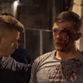 Un fan englez va avea nevoie de plăcuțe metalice pentru reconstrucția oaselor feței