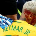 Neymar, plin de sânge // FOTO Reuters