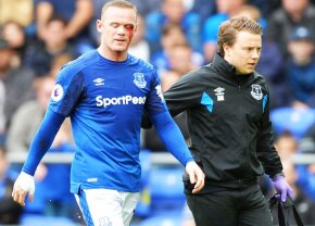 VIDEO + FOTO Imagini horror cu Rooney » Atacantul englez a fost umplut de sânge de un adversar