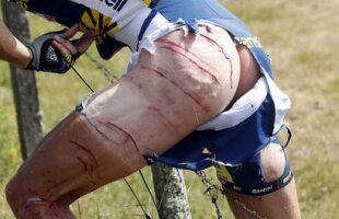 Accident şocant în Turul Franţei! » O maşină a lovit doi ciclişti