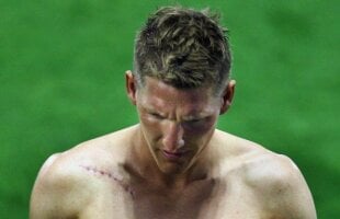 FOTO Schweinsteiger are o cicatrice de 10 centimetri pe umărul drept! :O