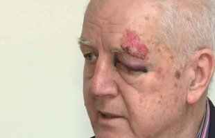 Pădureanu, jefuit în Bucureşti: "Sînt dispus să îl recompensez pe agresor dacă îmi restituie borseta furată"