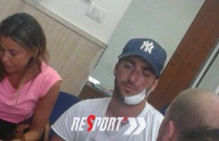 A dat cu faţa-n stîncă! » O ieşire cu barca s-a terminat prost pentru Higuain