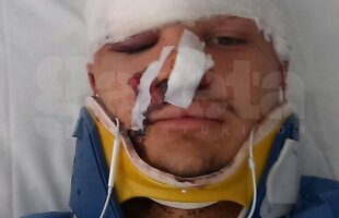 Alex Buziuc a fost externat din spital după ce maşina în care se afla a intrat într-o căruţă: "Mai am 6 vieţi!"