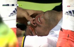 VIDEO + FOTO Accidentare horror pentru Van Persie! Și-ar putea pierde un ochi