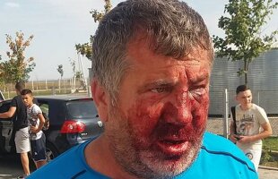 UPDATE Ce pedepse au primit cei implicați în cazul antrenorului român desfigurat sâmbătă. Atenție, imagini DURE!