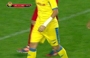 Un fotbalist cu proteză la mână a jucat în Cupa României: "Un TIR era să-mi distrugă visul"