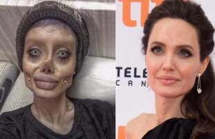 FOTO Și-a făcut 50 de operații pentru a semăna cu Angelina Jolie! Rezultatul e devastator
