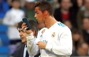 VIDEO+FOTO » Selfie plin de sânge în Real Madrid-Deportivo! Imagini horror cu Cristiano Ronaldo, care a cerut un telefon să vadă unde e tăiat la față