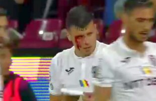 CFR CLUJ - FC BOTOȘANI 1-1 // FOTO Imagine horror! Țucudean a ieșit cu fața tumefiată după meciul cu FC Botoșani