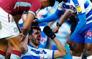 NELSON OLIVEIRA // FOTO ȘOCANT! Accidentare horror la un meci din Anglia: umplut de sânge după ce a fost călcat pe față