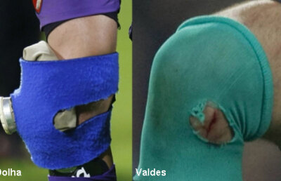 Ce au în comun Valdes şi Dolha » "Operaţie" fără anestezie