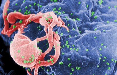 Vaccinul anti-HIV, tot mai aproape de realitate