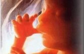 Miracolul vieţii: un caz în cinci milioane. A născut gemeni deşi avea două utere