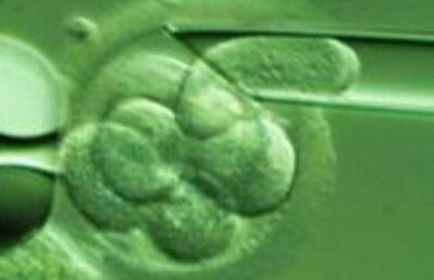 Joaca de-a Dumnezeu: Cercetătorii au creat embrioni umani din celule ale pielii