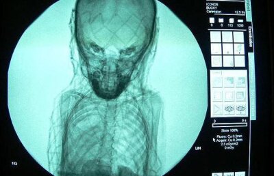 Misterul unei mumii, dezvăluit de o radiografie