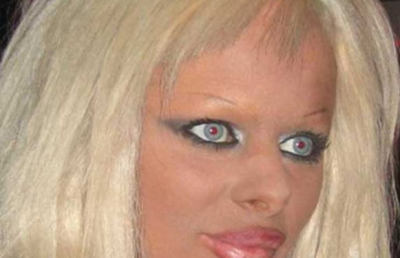 FOTO! Top 7 cele mai infricosatoare buze cu botox!