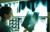 Alertă de TBC în Iaşi. Peste 160 de persoane au fost chemate la analize