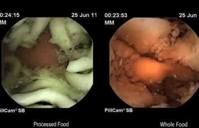 Ce se întâmplă în stomacul nostru când mâncăm preparate şi semi-preparate (Video)