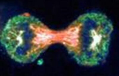 Britanicii au descoperit o proteină care ar putea opri evoluţia cancerului ovarian